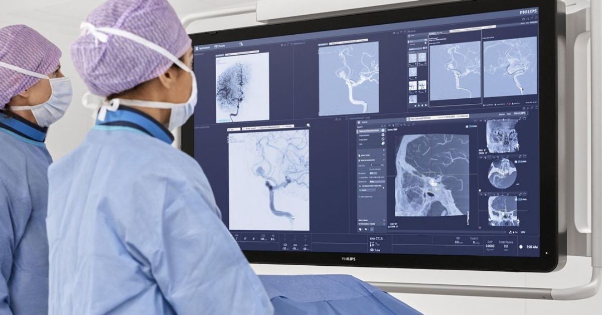 La tecnología mejora la atención al ictus