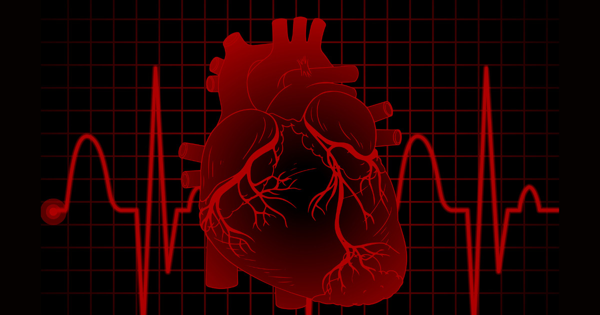 ataques al corazon