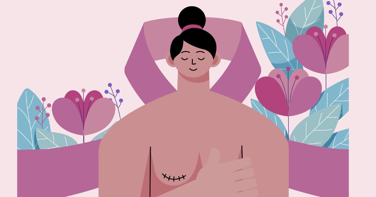 cáncer de mama